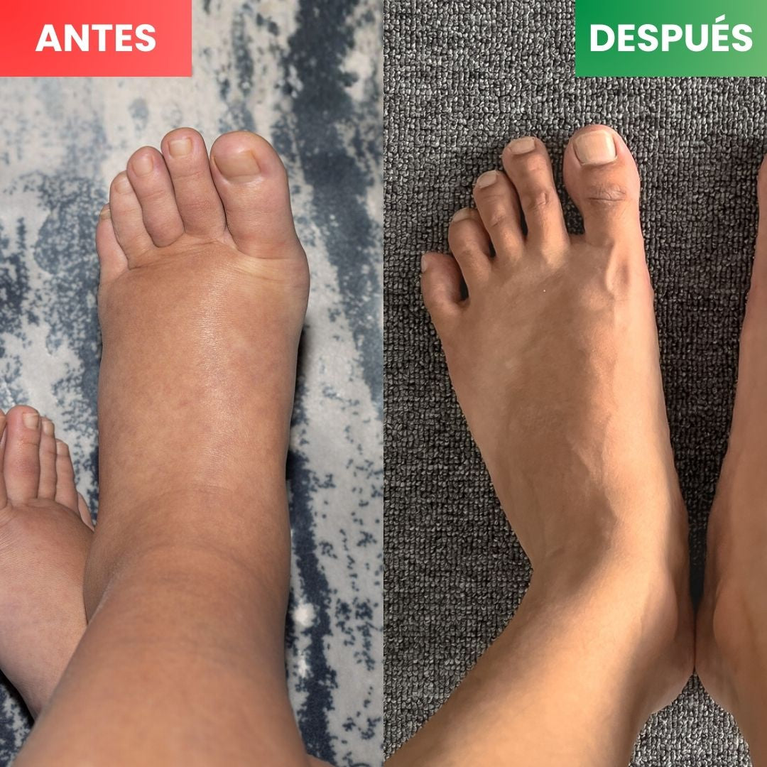 Calmora™ – Tobillera Térmica Masajeadora